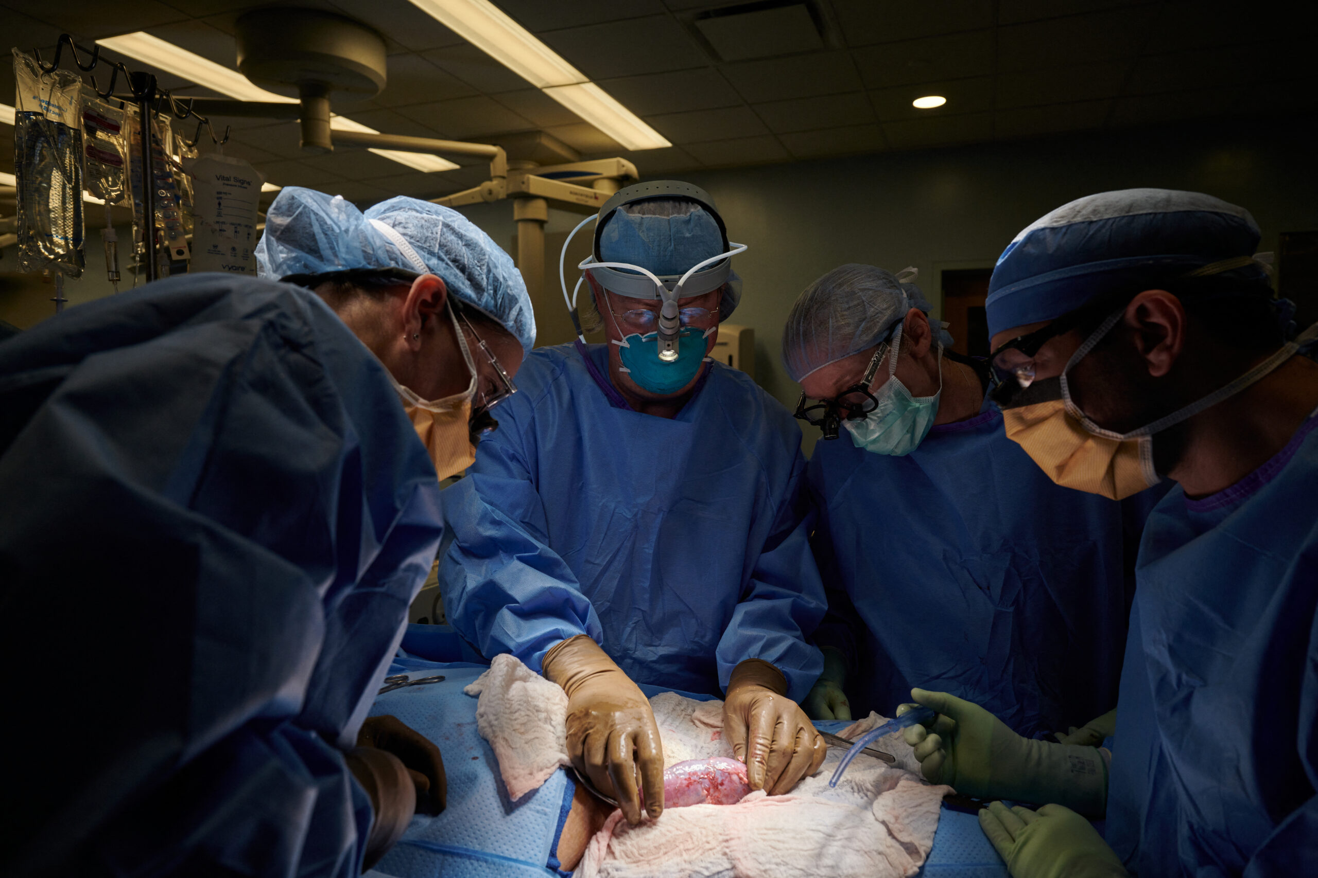 A surgical team examines the genetically engineered pig kidney.